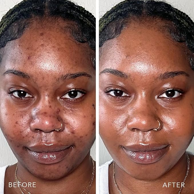 Doll 10 TCE Liquid Filter - Covers, Blurs, and Brightens (Deep)