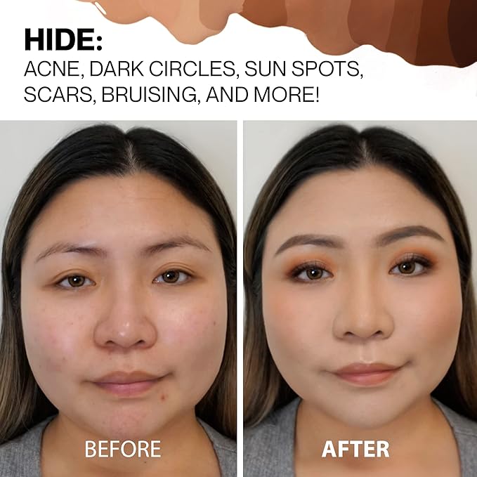 HIDE Liquid Concealer, Medium to Full Coverage Concealer for Blemishes, Under Eye Dark Circles & Scars, Oil Free Concealer, Champagne (See Shade Finder), 0.5 fl oz