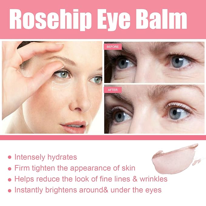 Rosehip Eye Cream Stick, Moisturizing, Hydrating, Lightens Lines and Dark Circles, Lifting, Firming