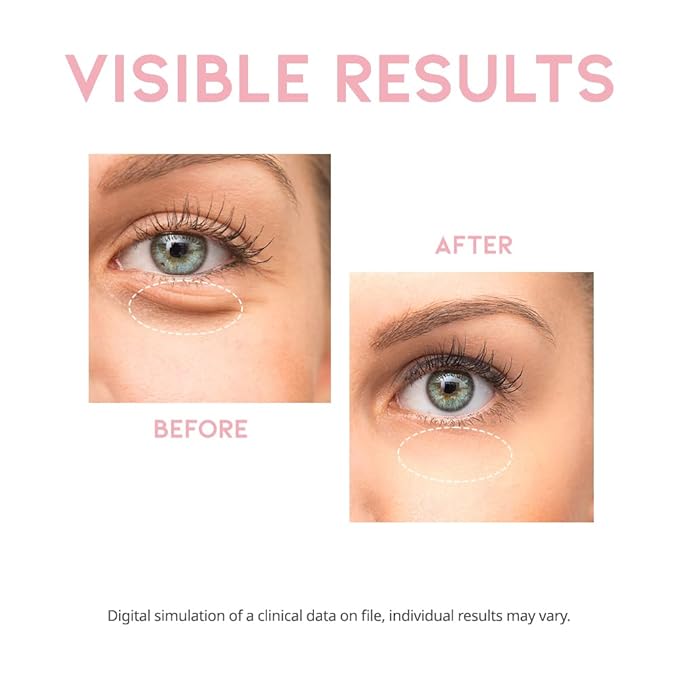 Caffeine eye cream serum for