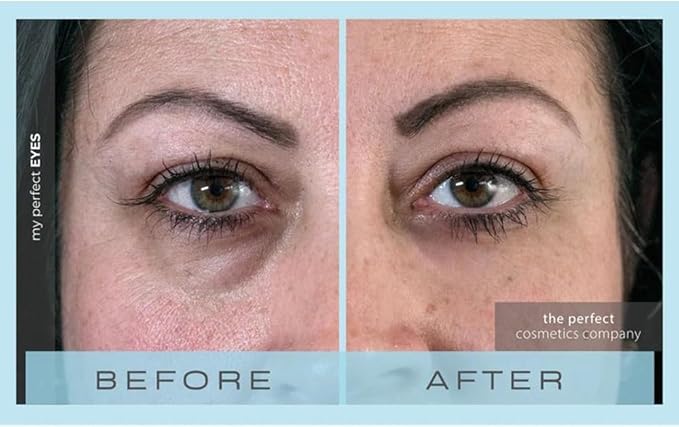 My Perfect Eyes 20ml, 200 Applications, Penny Lane, Instant Results, Clinically Proven, Anti-Ageing Serum UK Original Formula, Science-Backed Anti-Wrinkle Serum. As Seen on TV.