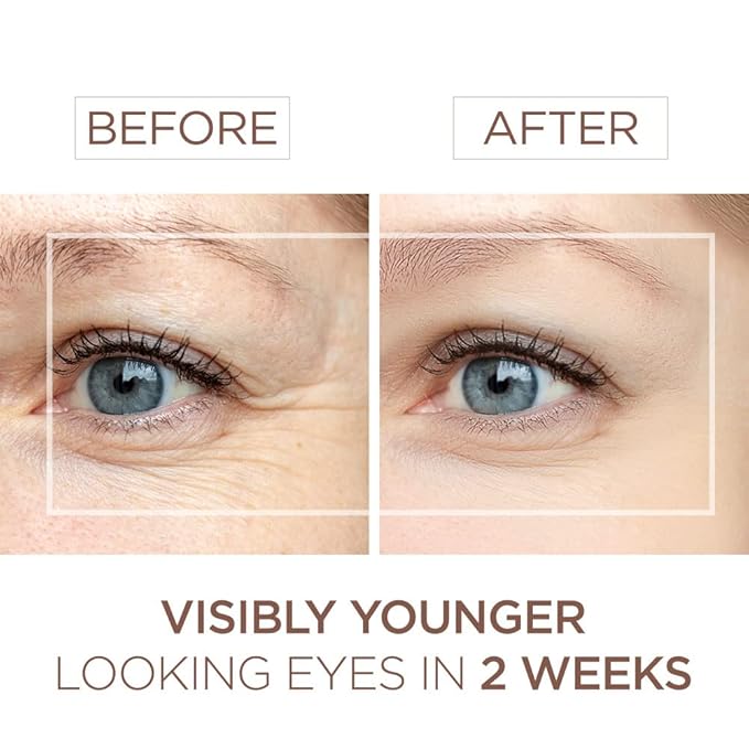 BEE and YOU Eye Cream, Anti Aging, Anti Wrinkle Serum 100% Natural with Bee Venom, Propolis Extract, Raw Honey, Hyaluronic Acid, For Dark Circles Under Eye Treatment and Puffiness, Skin Care, 15ml