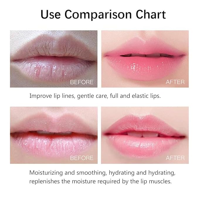 20Pcs Moisturizing/Plumping Lip Mask, Restores Moisture