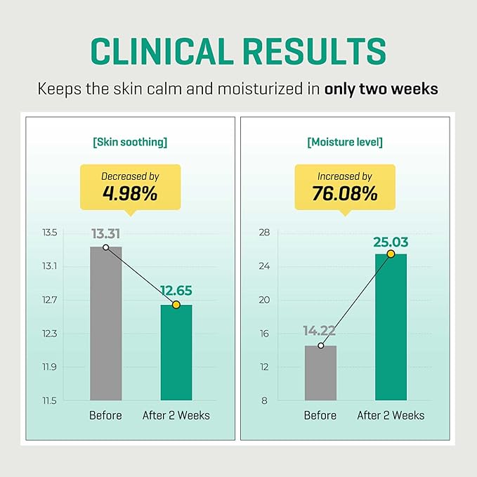 SOME BY MI AHA BHA PHA 30 Days Miracle Serum Light - 1.69oz, 50ml - Daliy Exfoliating Salicylic Acid Serum for Pore and Blackhead Care - Centella & Niacinamide for Skin Soothing - Korean Skin Care