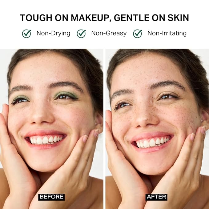 Y'OUR Soothing Micellar Cleansing Water | Removes Waterproof Makeup for Face, Eyes & Lips | Hydrating, Oil Control & Non-Irritating for Sensitive Skin | with Aloe Vera & Fruit Extracts