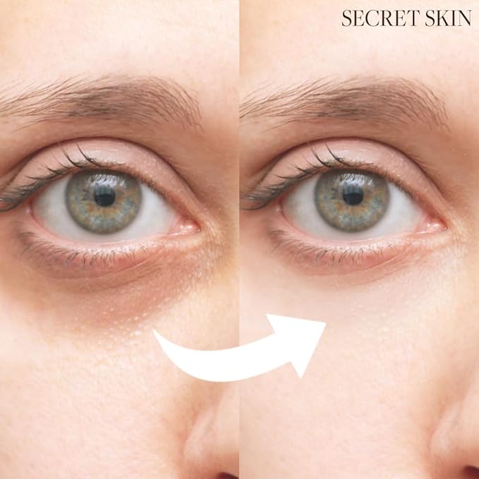 SECRET SKIN Snail+EGF Perfect Cream Wrinkle Bounce Firming Fine line Care Korean Skin Care (#01 Eye Cream)