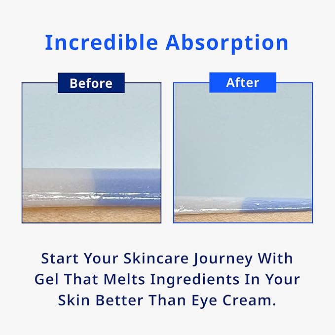 Moist Moment Under Eye Patches | Hydrating Eye Treatment Gel Masks With Hyaluronic acid & Squalane | Under Eye Masks For Dark Circles and Puffiness, Under Eye Bags, Wrinkle Care, Men and Women