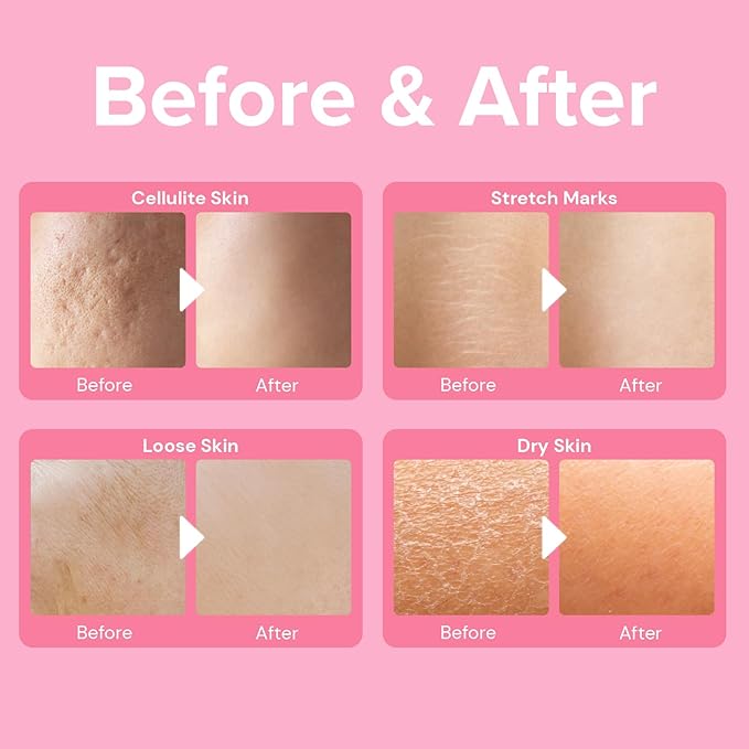 Enaskin Naturals Anti Cellulite Cream: Skin Firming and Tightening Lotion for Booty, Legs & Belly - Lifting Body Mask for Women Loose Skin, Lift & Firm Moisturizing Bum Bum Care