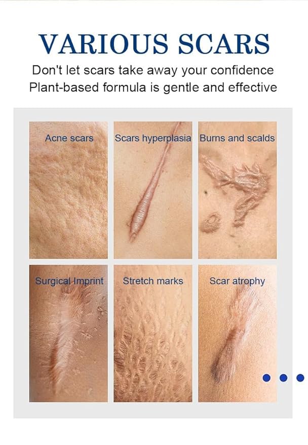 Advanced Scar Cream Gel, Scar Removal