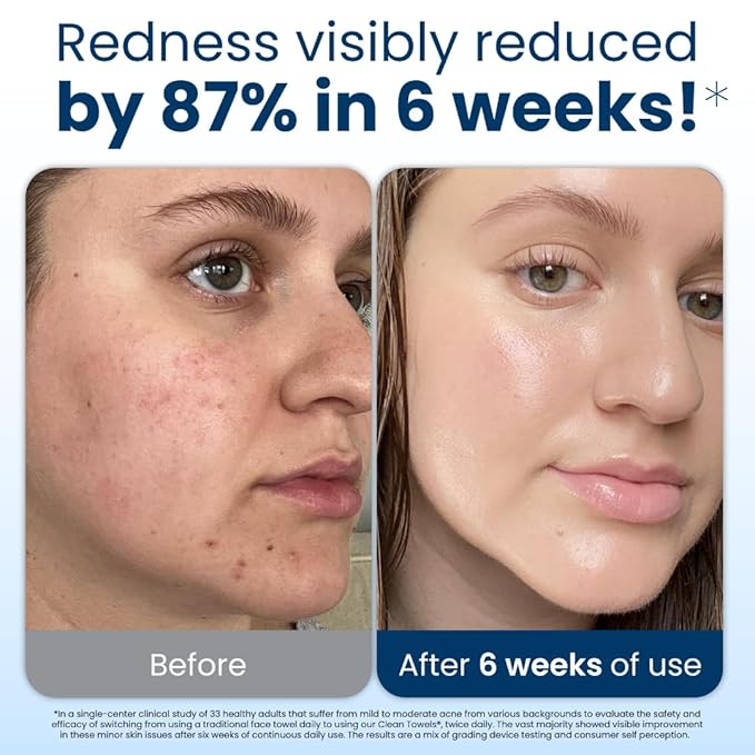 Clean Skin Club Clean Towels XL™, 100% USDA Biobased Dermatologist Approved Face Towel, Disposable Clinically Tested Face Towelette, Facial Washcloth, Makeup Remover Dry Wipes, 300 ct, 6 pack