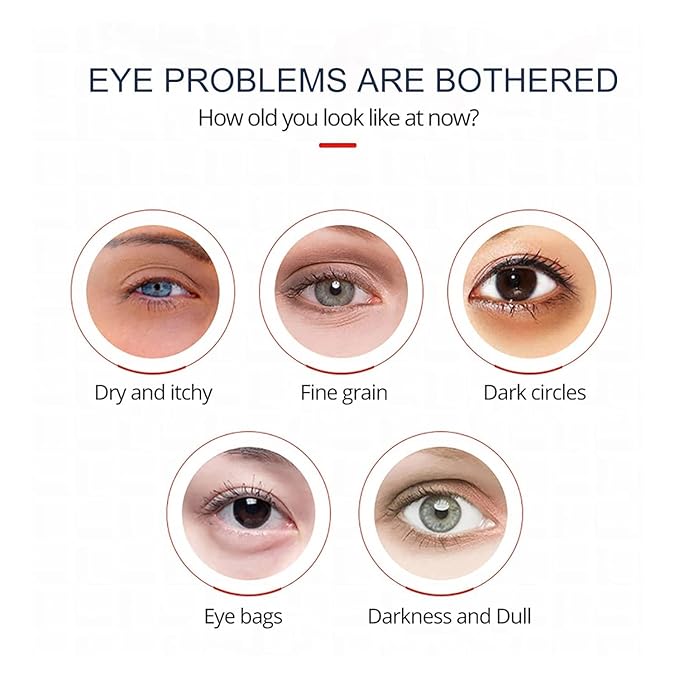 Open eyes awaken peptide lifting eye gel,peptide eye lifting gel,Reduces Dark Circles, Dark circles Hydrating firming Eye cream (7PCS)