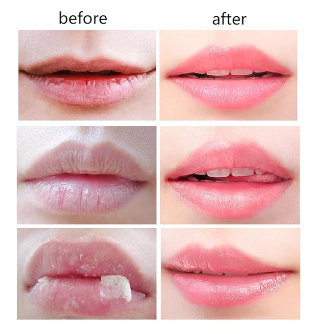 2 PCS Bee Lip Balm Honey Lines