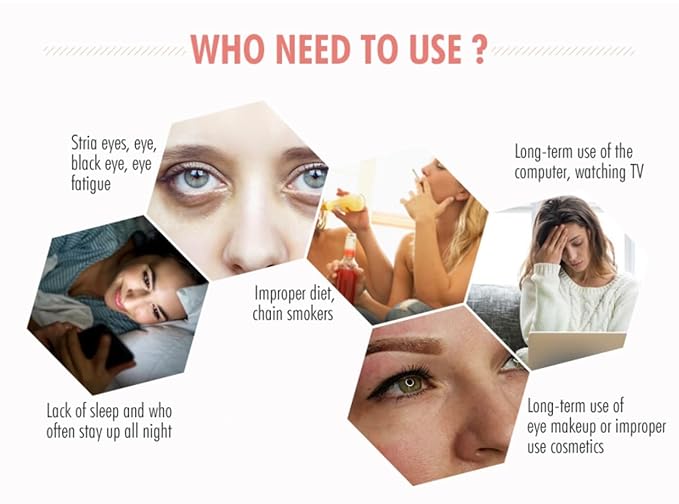 Under Eye Patches (30pcs) - Rose, Gold, hydro-gel Under Eye Mask Amino Acid & Collagen, Under Eye Mask for Face, Dark Circles and Puffiness, Beauty & Personal Care