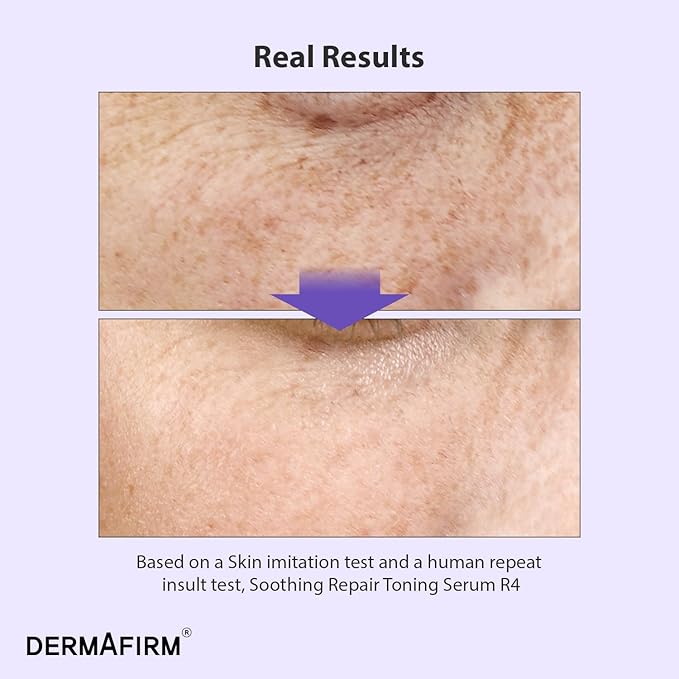 [Refill] DERMAFIRM Soothing Repair Toning Serum R4 - Korean Bakuchiol Retinol Niacinamide & Peptide Face Serum for Wrinkles - Calming, Moisturizing & Correcting- Paraben-Free, Cruelty-Free, 1.01 fl oz