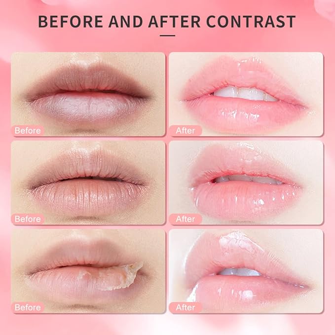 Lip Scrub, Lip Scrubs Exfoliator Moisturizer