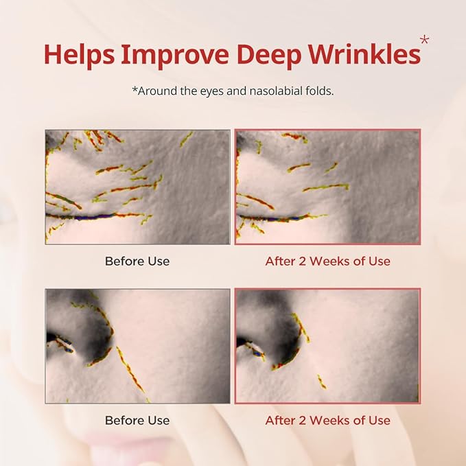 Dermatory pro vita-a retinal under