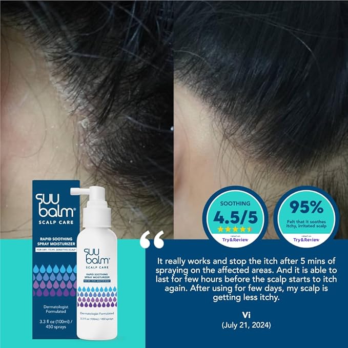 Rapid Itch Relief Anti-Dandruff Scalp Spray Moisturizer, Dry Scalp Spray, Cooling Itchy Scalp Treatment for Flaky Sensitive & Psoriasis, Derm-Formulated. Menthol & 5 Ceramides, 1.35 fl oz