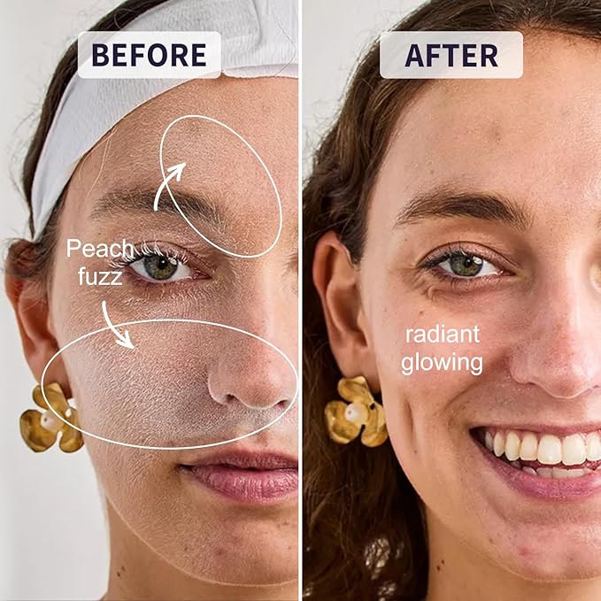 Dermablade, Dermaplane Razor Refill Blades, Stainless Steel Blades with Safety Micro-guards, Gently Exfoliates Skin | 12 count | No Handle | Only fit THURLADY Dermaplane Razor