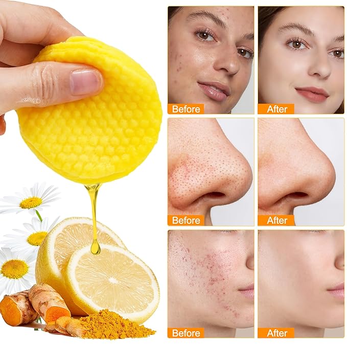 Turmeric cleansing pads,turmeric cleansing exfoliating