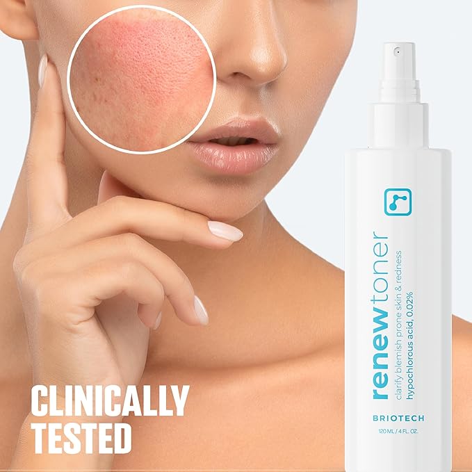 BRIOTECH Skin Renew Toner, Hypochlorous Acid Spray Topical Skin Spray for Face and Skin, Minimize Appearance of Blemishes, Soothing Mist for Redness & Bumps, 4 fl oz