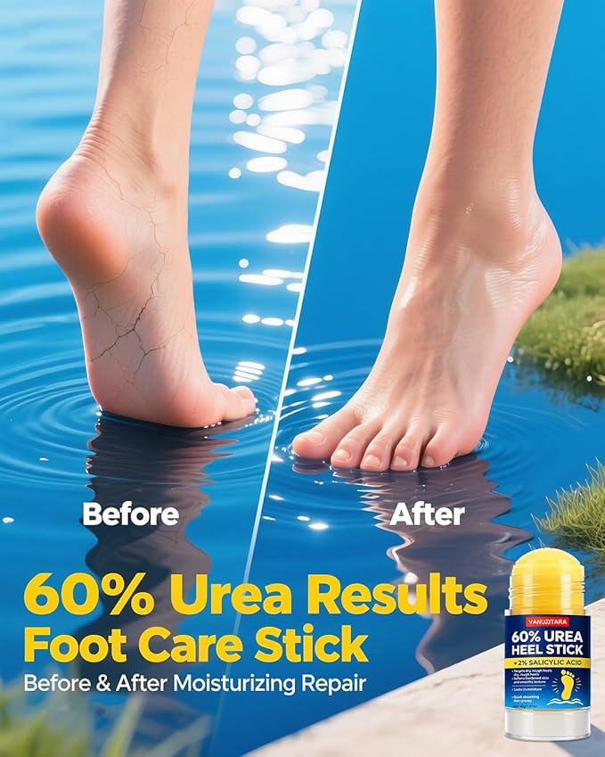 60% Urea Heel Stick l Maximum Strength Urea Stick for Rough, Dry Cracked Feet Hands Elbows, Callus Remover, Skin Softener Balm 1.41oz