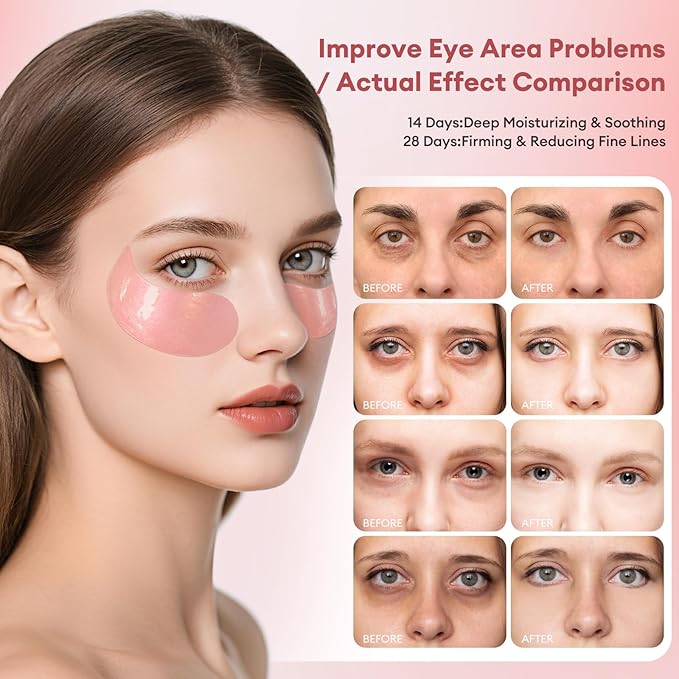 Under Eye Patches Gold Essence Hydrogel Eye Masks for Puffy Eyes and Dark Circles Caffeine Hyaluronic Acid & Niacinamide Deep Hydrating Eye Mask for Men & Women 60 PCS (Rose-pink)