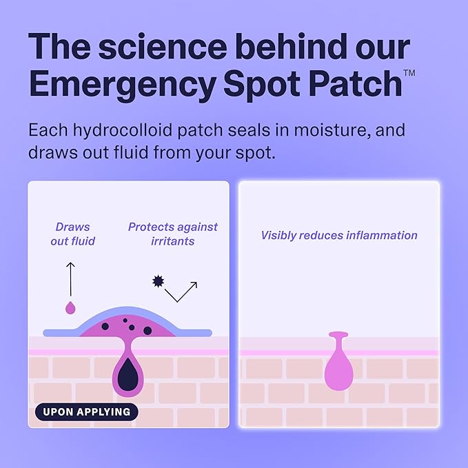 Curology Emergency Spot Pimple Patches for Face, Stocking Stuffer Gifts, Hydrocolloid Pimple Patches Fast-Acting, 160 Count