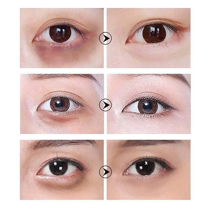 30 Pairs Hyaluronic Acid Collagen Eye Mask,Moisturizing Brightening Eye Mask, Eyes Treatment for Reducing Dark Circles, Lighten Wrinkles Anti-Aging, Fine Lines Eye Bags Puffiness for Women Men