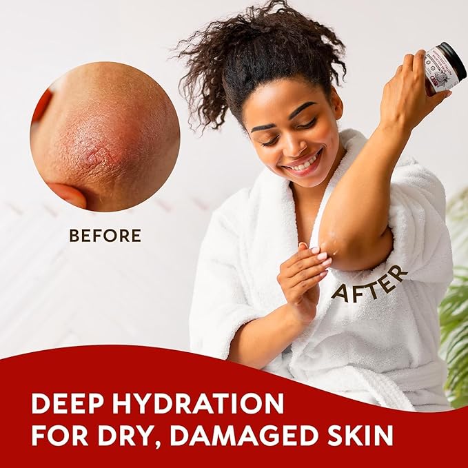 Beef Tallow for Skin, 4 Pack (17.2 fl oz) - Whipped Grass-Fed Moisturizer with Wild Honey & Beeswax, Natural Face & Body Care, Deep Hydration, Anti-Aging, Sensitive Skin Safe