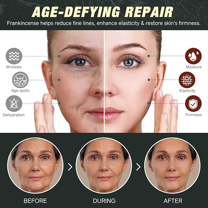 Tallow Castor Oil Frankincense Oil Handmade Skin Balm, Face & Body Moisturizer for Sensitive Skin, Eczema All-Purpose Balm, 100% Grass-Fed Tallow for Skin Care