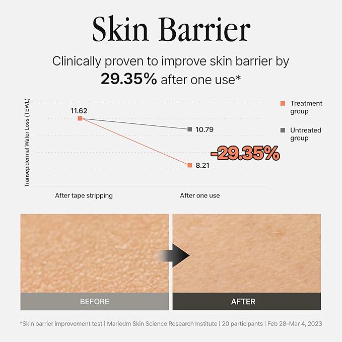 Silver Frost Mist - Facial Barrier Toner Spray with 80% Witch Hazel Water, Cica for Skin Barrier Repair, Recovery for Sensitive Skin, Dewy Hydration, Korean Skin Care (1.69 fl oz)