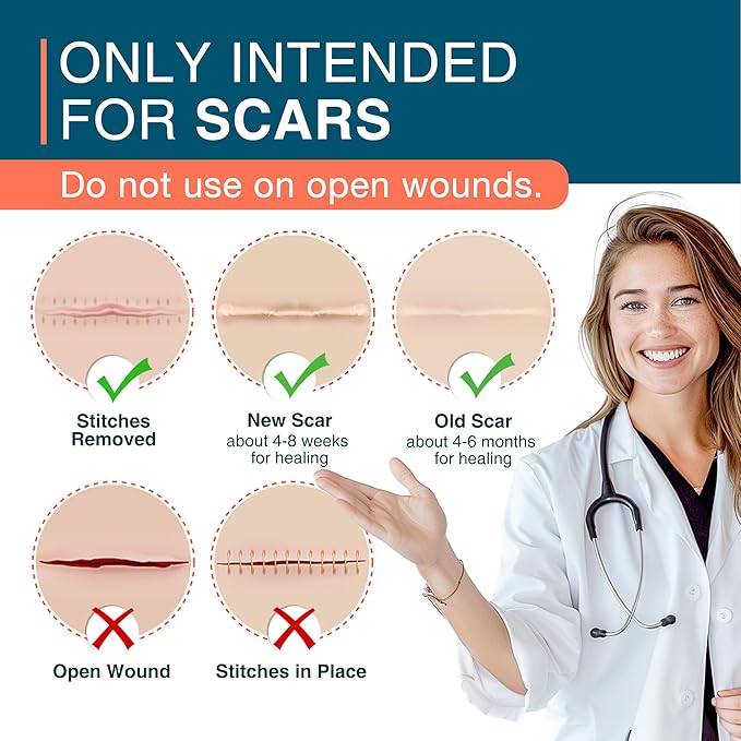 Silicone Scar Sheets, 1.5¡± x 156¡±