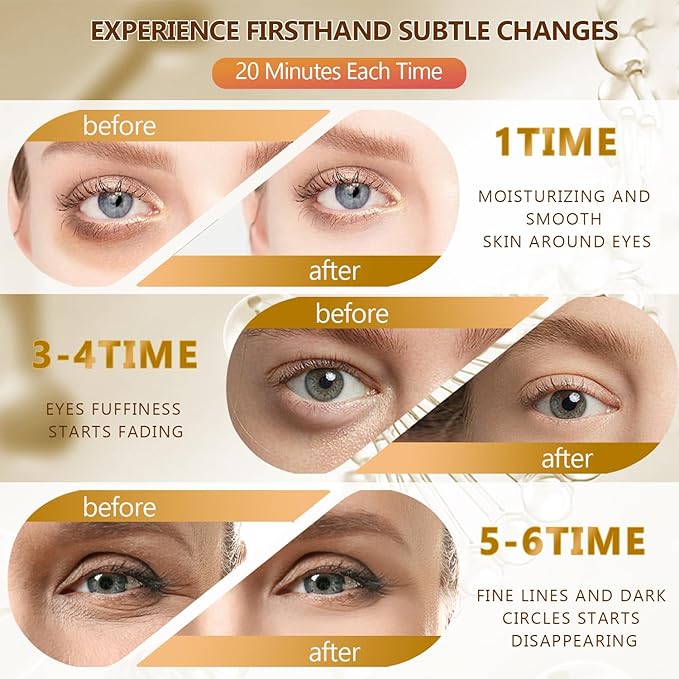 60 Pcs 24K Gold Under Eye Patches with 5 Pieces Travel 24K Golden Eye Mask, 30 Pairs Women Undereye Mask for Dark Circles Puffy Eyes Treatment, Men Gel Pads Hydrating for Puffiness Wrinkle