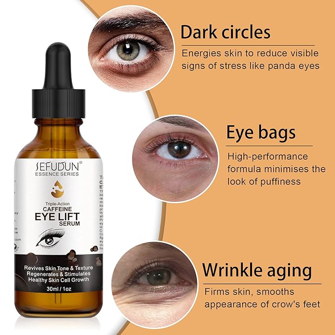 Dark Circles Under Eye Treatment for Women Caffeine Serum Circles, Puffiness, Bags, Anti Aging Reduces Wrinkles and Fine Line, 100% Pure Coffee Oil - 1 oz / 30 ml, 1 Fl Oz (Pack of 1)