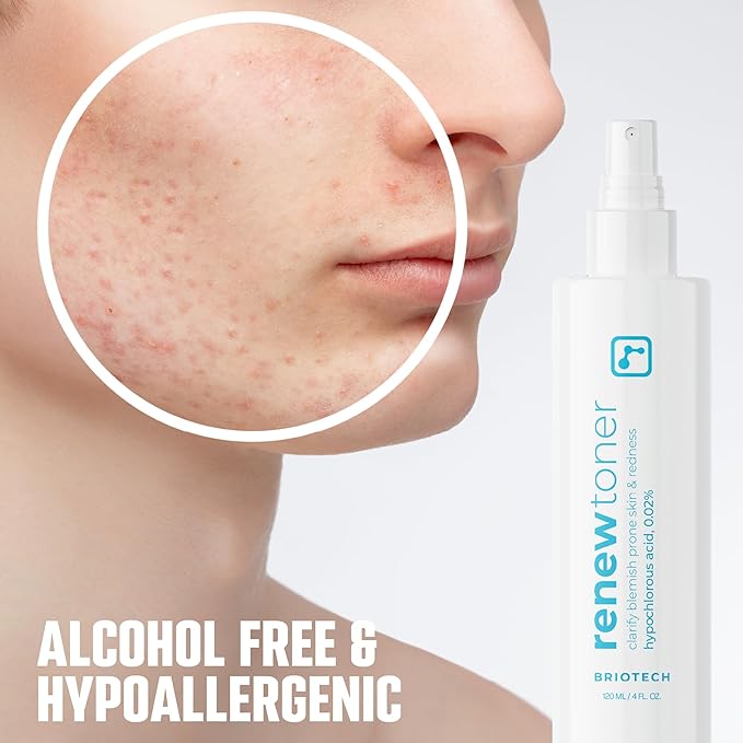 BRIOTECH Renew Toner, Hypochlorous Acid Spray, Minimize Appearance of Blemishes, Soothing Facial Mist for Sensitive Skin, Calm Redness & Bumps, Hypoallergenic & Vegan, 2 fl oz Travel Size (2)