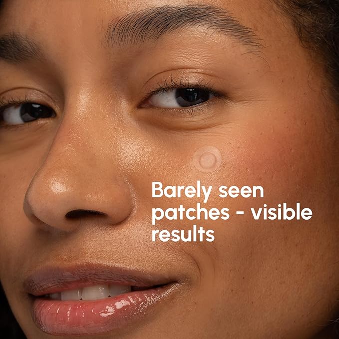 MAREE Invisible Pimple Patches 2 PACK - Clear Pimple Patches for Face - Hydrocolloid Acne Patches Anti Blemish - Zit Stickers for Face - Parches Para Acne - Pinple Zit Pimple Stickers - 144 Dots