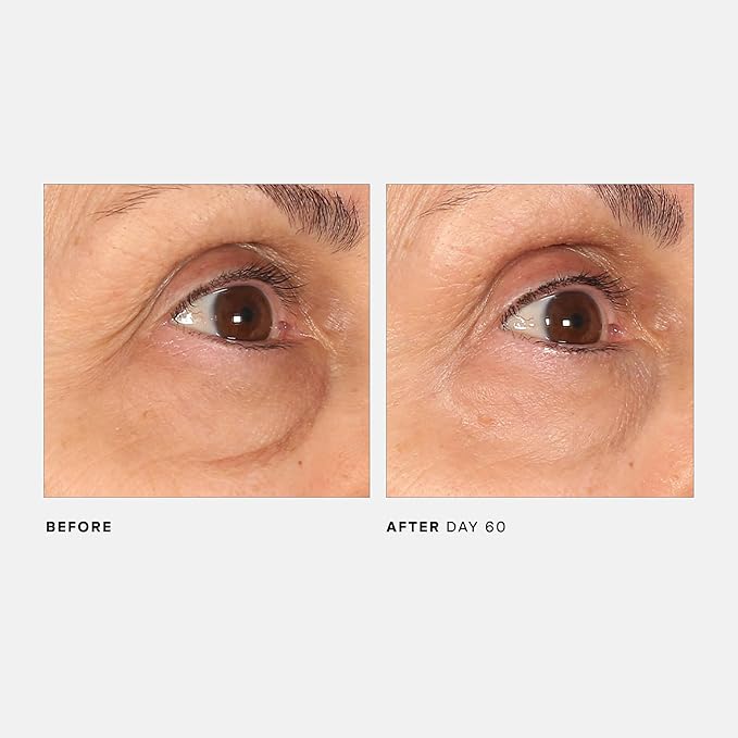 U Beauty The RETURN Eye Concentrate - Anti-Aging Eye Cream with Peptides and Antioxidants for Brighter and Tighter Under Eyes, Reduce Fine Lines, Puffiness & Dark Circles - 0.5 fl oz