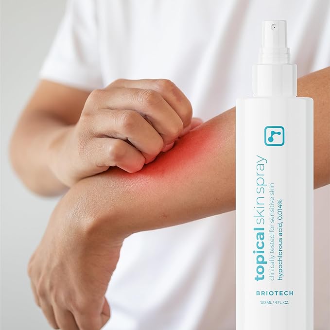 BRIOTECH Topical Skin Spray, Hypochlorous Acid Spray for Sensitive Skin, HOCl Facial Mist, Full Body Support Against Irritation, Calm Redness, Soothe Foot & Scalp, 8 oz (2 Pack)