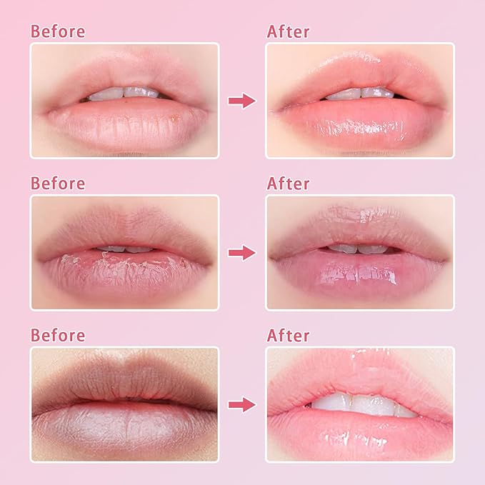 3 Pcs Bee Lip Balm Honey Lime)