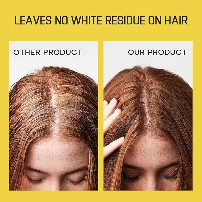 Dry Shampoo for Women, Dry Scalp Shampoo Spray for Dark Hair Leaves No White Residue, Absorb Oils, Volumizing & Refresh Hair for 72 Hours, 5.07 Fl Oz((Pack of 2)