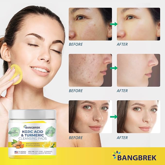 Kojic turmeric cleansing pads: turmeric