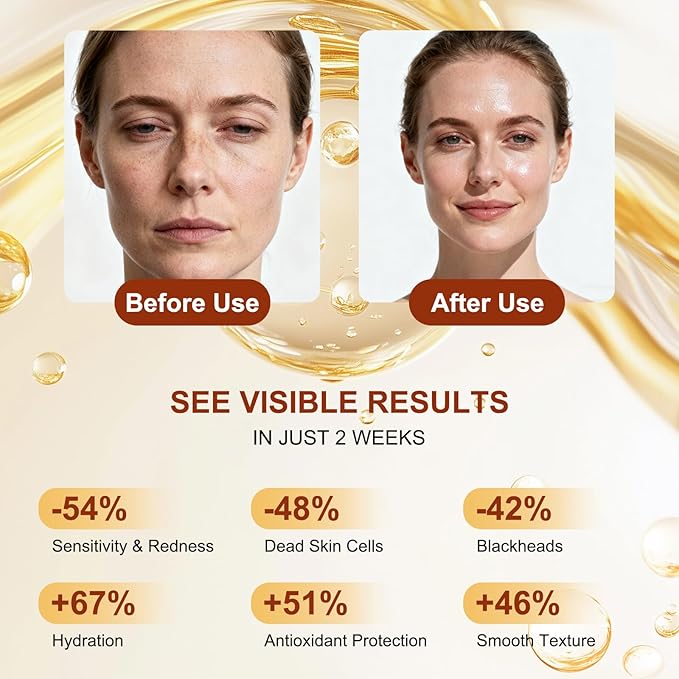 Peel Shot Glow White Rice Peeling Ampoule, White Rice Exfoliant for Face, Rice Peel Shot Minimizes Pores, Deeply Hydrating & Soothing, Gentle Scrub for All Skin Types, 80ml/2.7fl oz