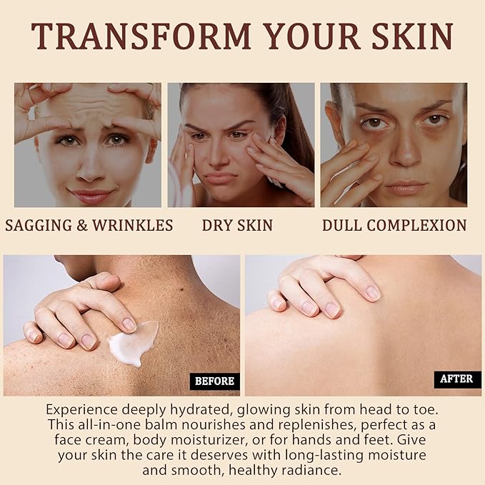 Organic Beef Tallow for Skin, Tallow Face Moisturizer, Tallow and Honey Balm, Grass-Fed Whipped Beef Tallow and Honey Cream, Deeply Moisturizing for Face & Body, Suitable for Dry & Aging Skin,4.2 oz