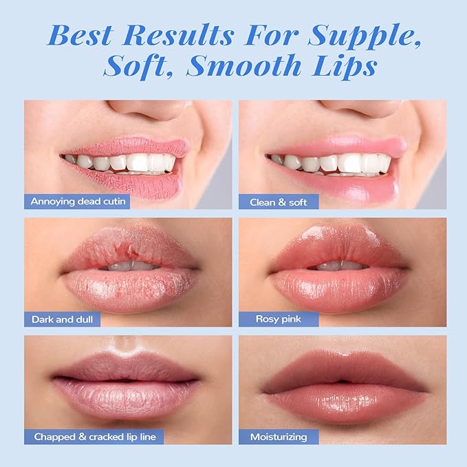 ANAI RUI Lip Therapy Set, Lip