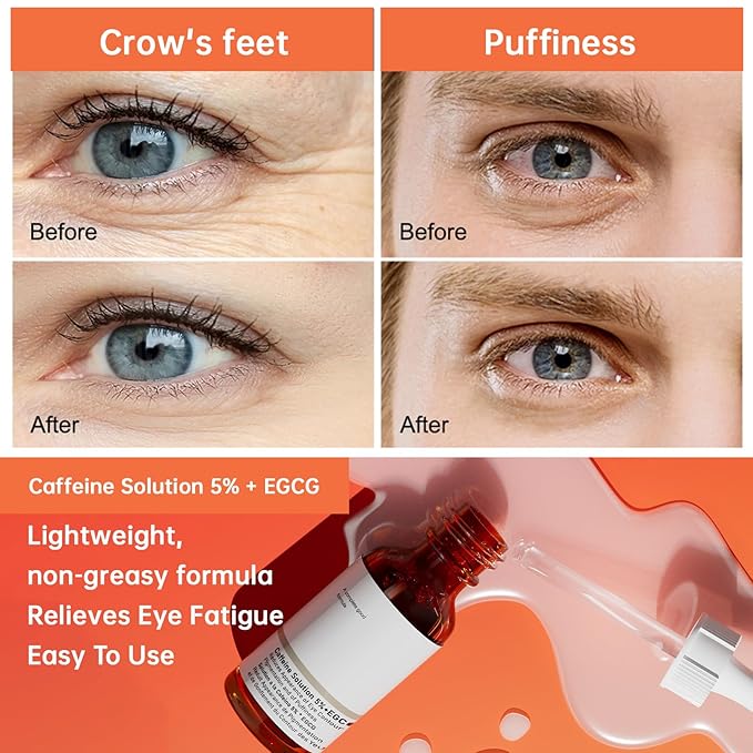 The Caffeine Solution 5% + EGCG，Reduces Appearance of Eye Contour Pigmentation and Puffiness，Under Eye Serum (30ml) Caffeine For Face Moisturizing Serum (2)