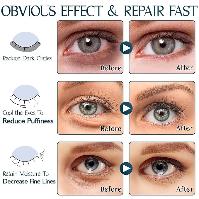 Under Eye Patches (60PCS), Aloe Vera & Collagen Eye Mask, Eye Patches for Puffy Eyes, Anti-Aging Eye Mask for Puffiness, Under Eye Mask for Dark Circles and Eye Bags, Hydrating Eye Gel Pads(green)