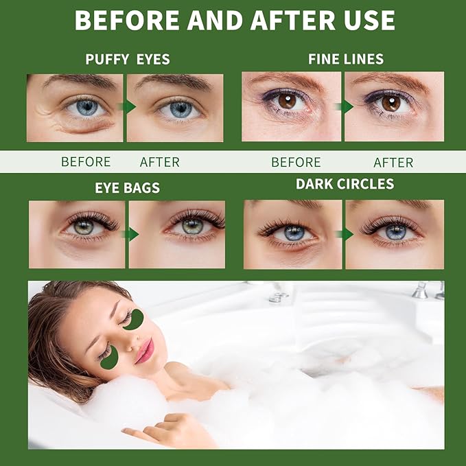 Under eye patches for puffy