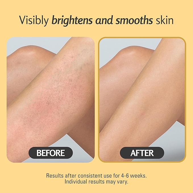 Exfoliating Turmeric Scrub and Skin Exfoliator with Collagen and Coconut Oil, Gently Exfoliates Face, Body, Hands, and Feet, Moisturizing Skincare, 16 oz by M3 Naturals