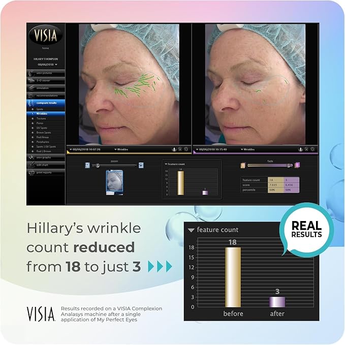 My Perfect Eyes 10ml, 100 Applications, Penny Lane, Instant Results, Clinically Proven, Anti-Ageing Serum UK Original Formula, Science-Backed Anti-Wrinkle Serum. As Seen on TV.
