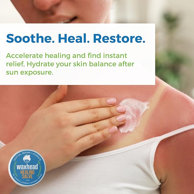 Waxhead Aftersun Body Butter for Sunburn Relief - Also great Tattoo Balm, Eczema Cream for Kids Adults, After Sun Lotion, Sunburn Treatment, Healing Salve